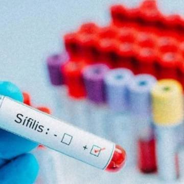 Aumentan los casos de sífilis en Salta