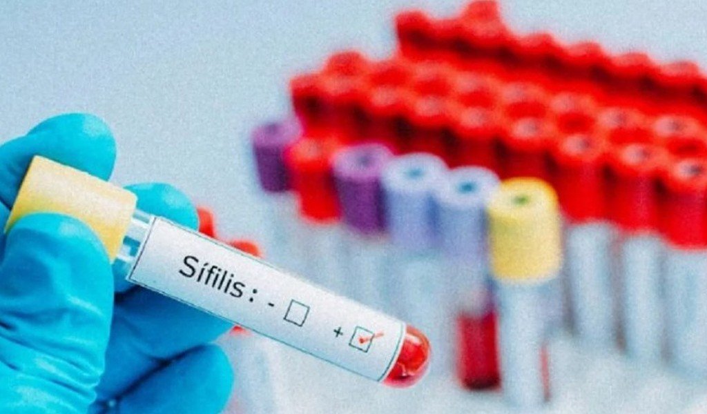 Aumentan los casos de sífilis en Salta